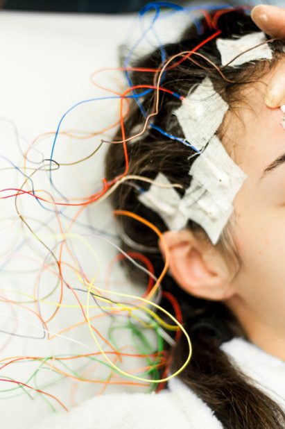 يعتقد بعض الأطباء أن الصرع من التأثيرات طويلة المدى لكورونا - iStock