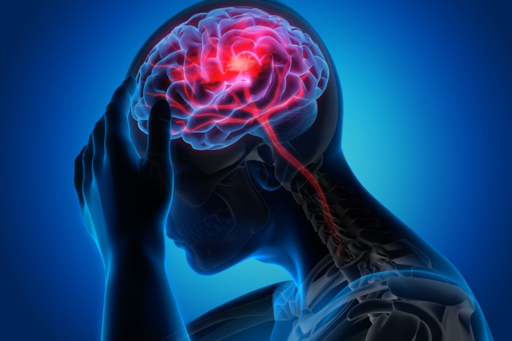 إليك الفرق بين السكتة الدماغية و السكتة القلبية و سكتة العين 