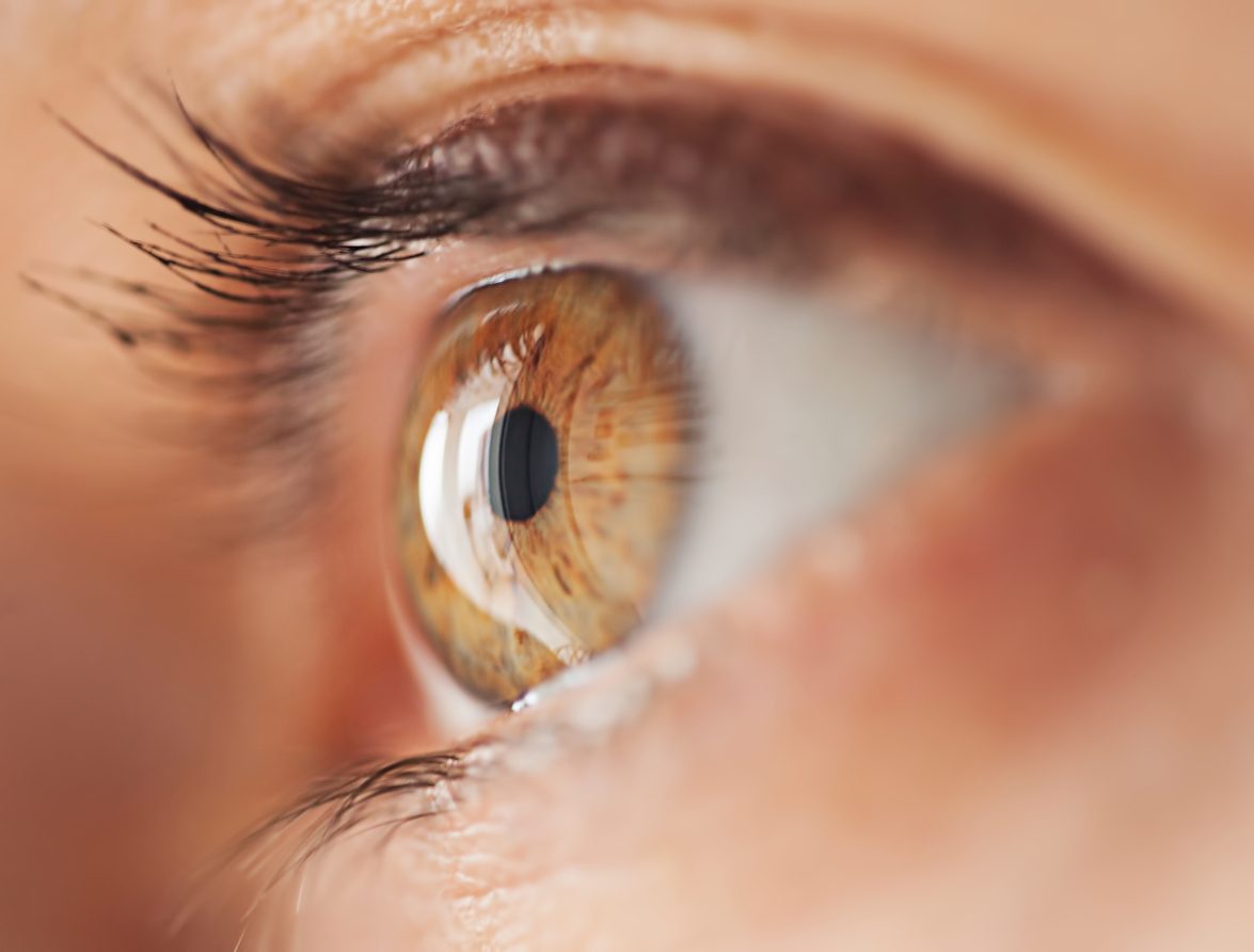 الليزك\ istock