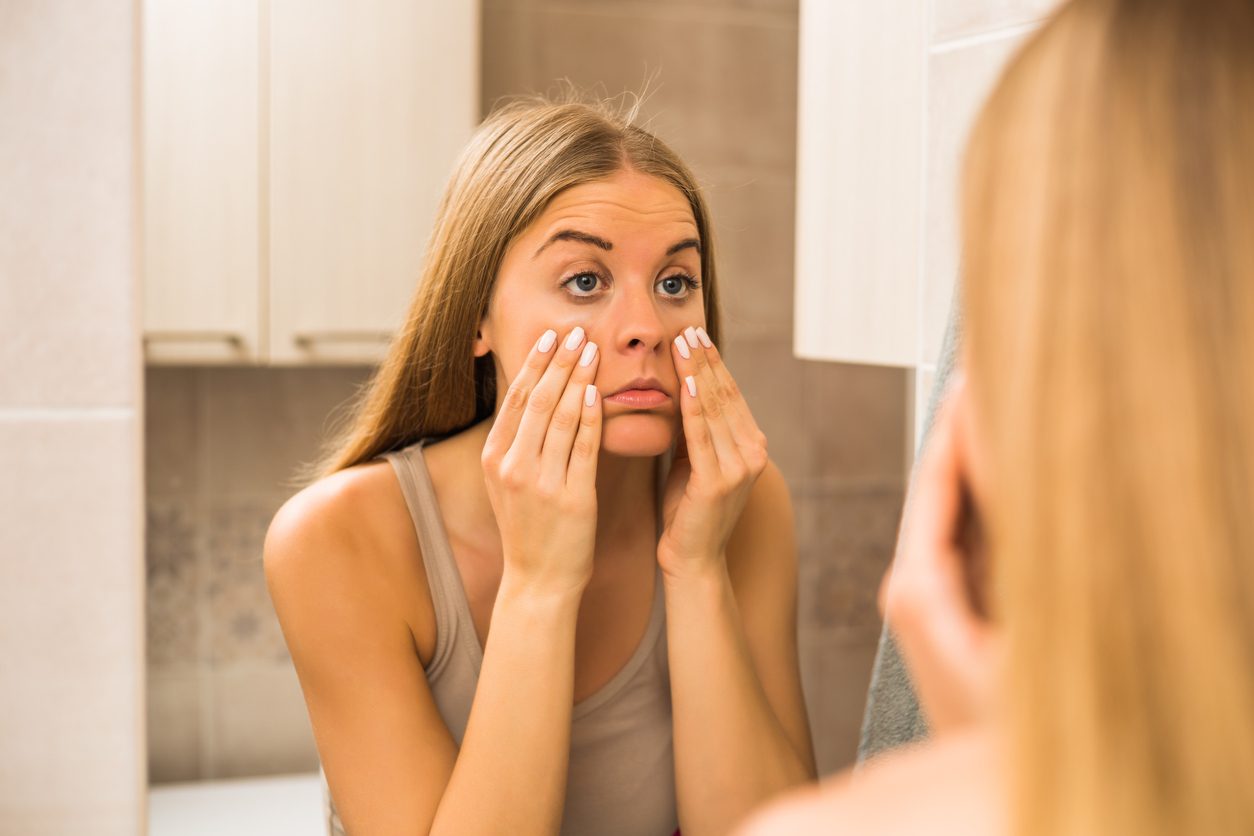 الإرهاق والتعب يظهران بشكل خاص على الوجه والعينين - iStock