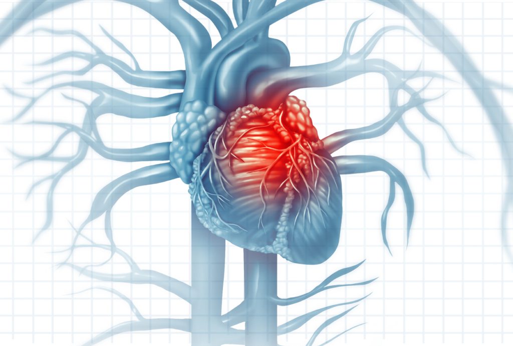 iStock/ لطالما اعتُبِرت أمراض القلب من الأمراض المزمنة والتي لا تسبب العدوى.