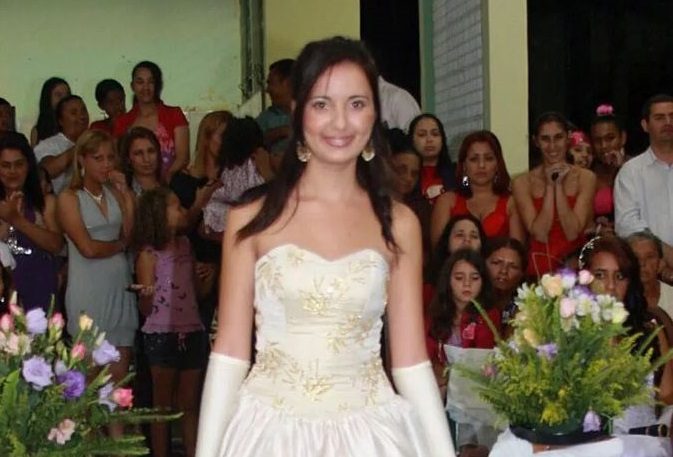 صورة لعارضة الأزياء في فترة المراهقة وقبل إجراء العمليات الجراحية - Caters News Agency