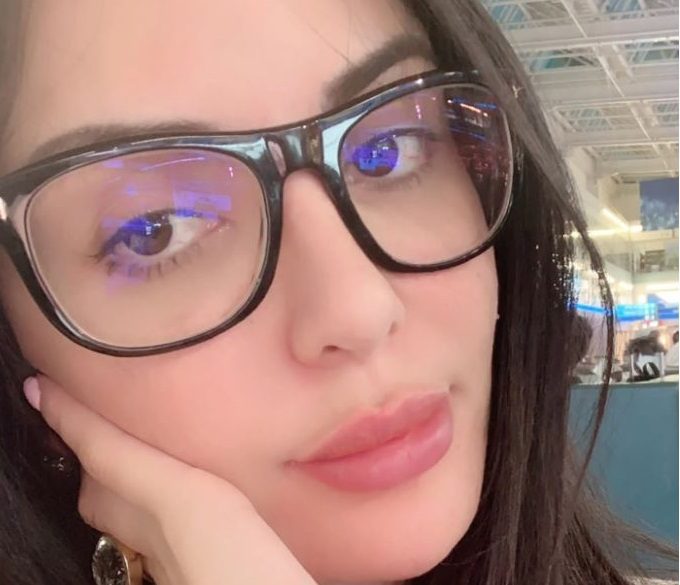 عارضة الأزياء بعد عمليات التجميل التي أجرتها لتصبح شبيهة بكارداشيان - Caters News Agency