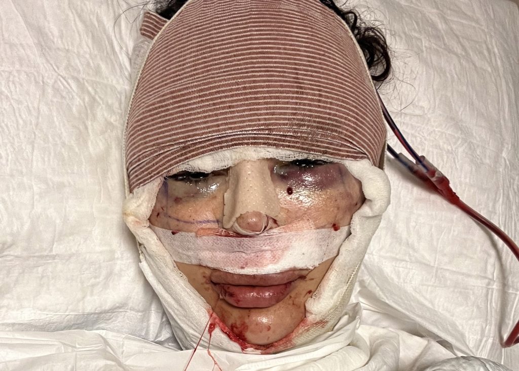 عارضة الأزياء بعد إجراء عمليات جراحية لتعود لمظهرها الحقيقي - Caters News Agency