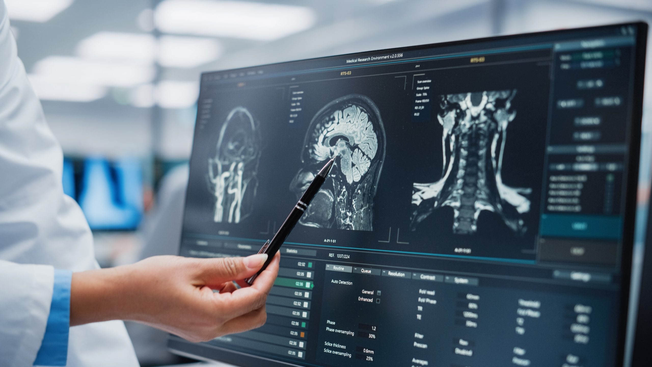 Shutterstock\<strong>التفكير يحرق السعرات الحرارية أيضاً </strong>