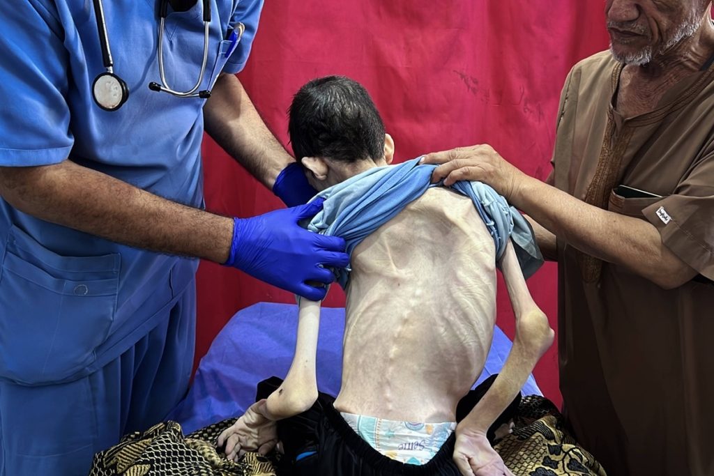 منتجات غذائية عربية تجويع غزة